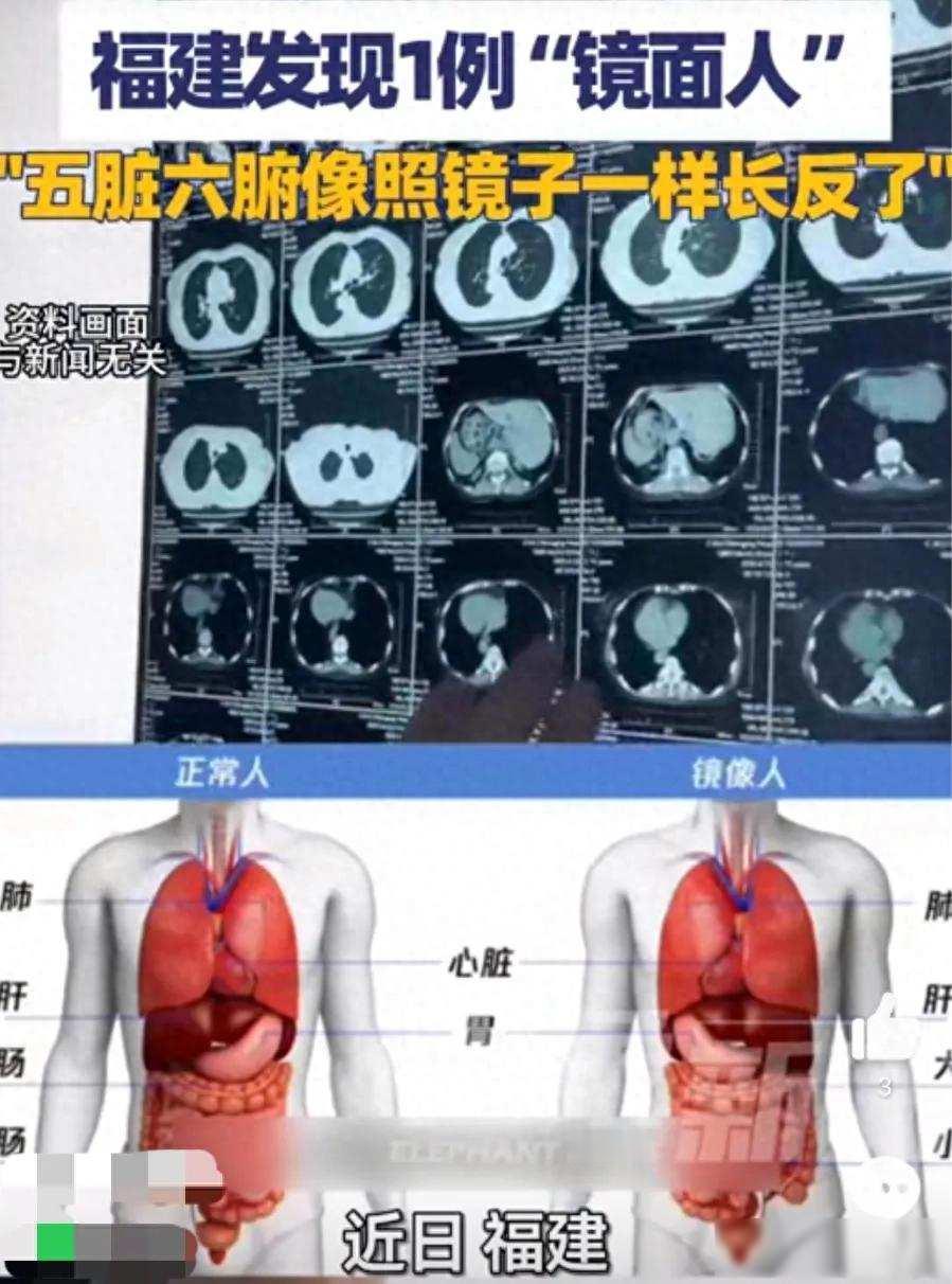 万万没想到！肚子疼背后藏玄机，CT一出，医生：手术方案重做！

福建有个男人一直