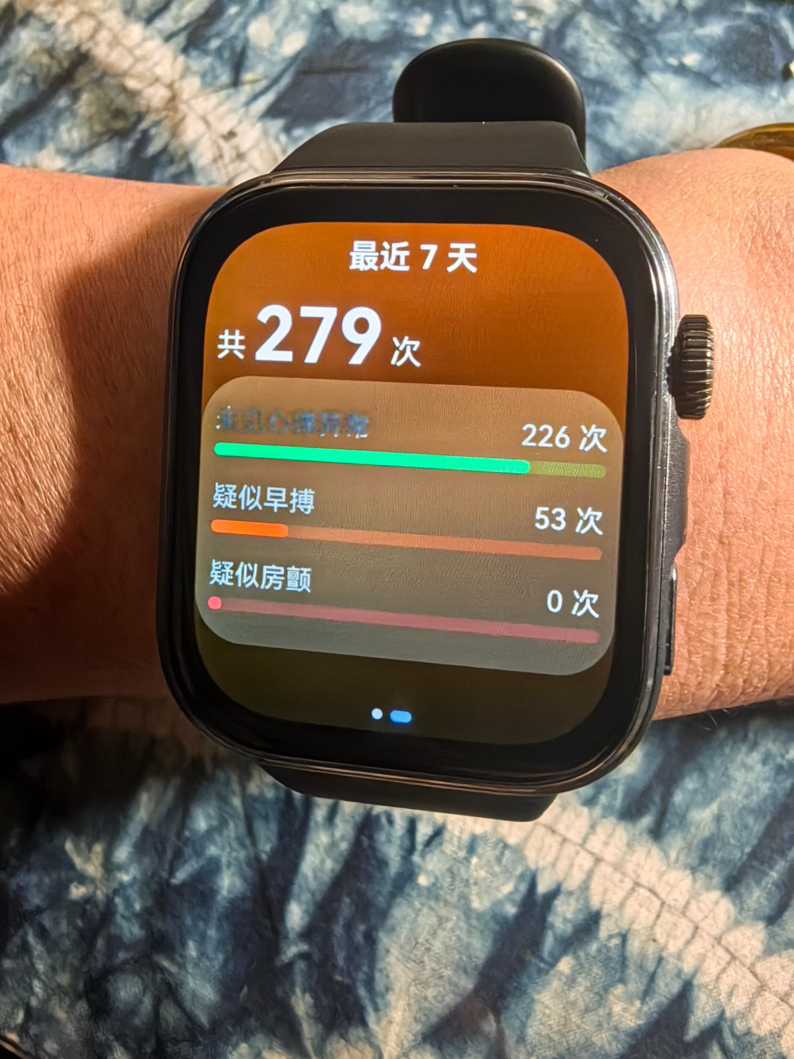 *碎碎念*小雪，我俩吃火锅，我喜肥牛他喜羊肉，各取所需，棒棒哒...一周早搏测试