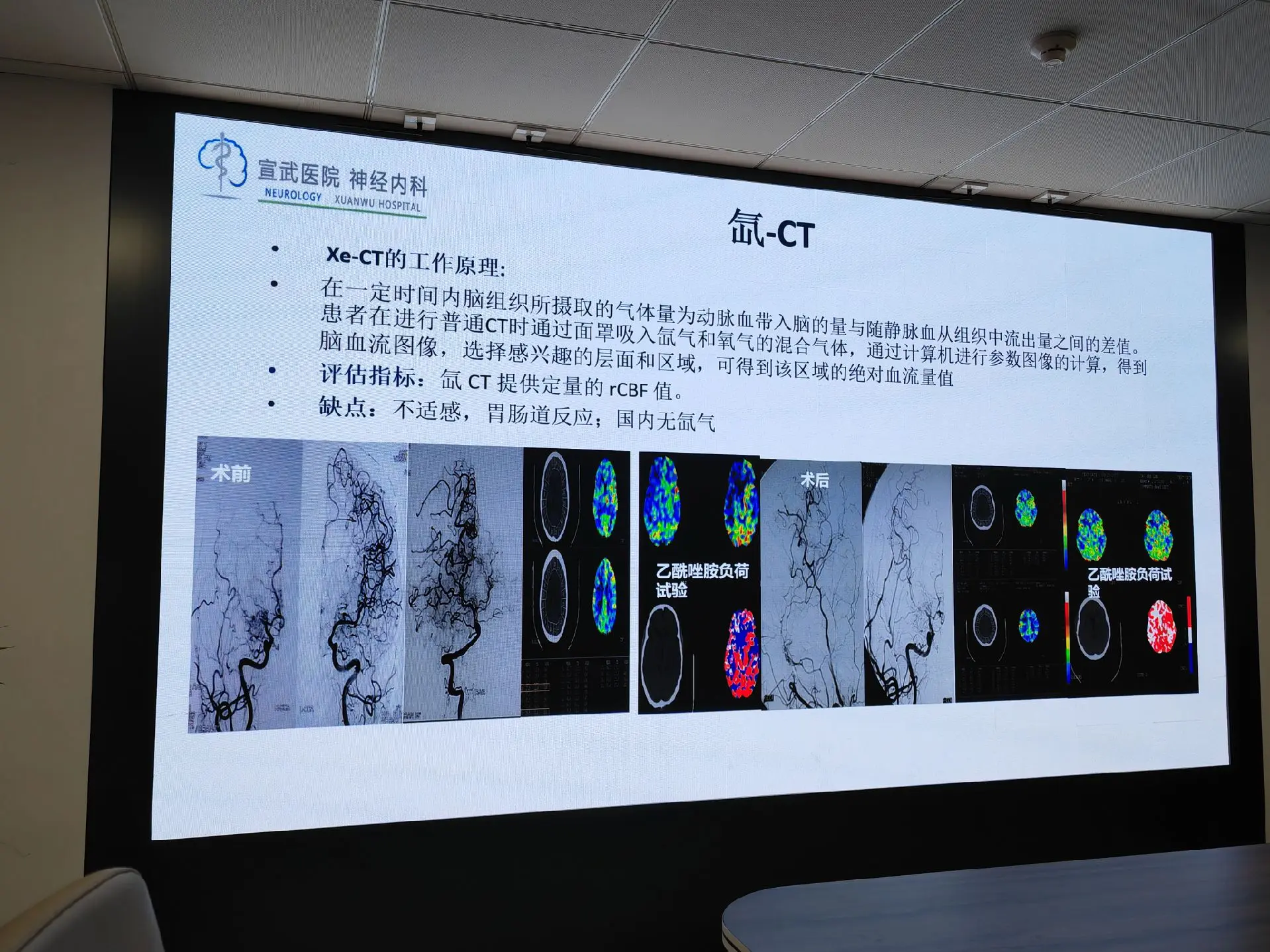 脑血流的储备功能评估及临床应用。