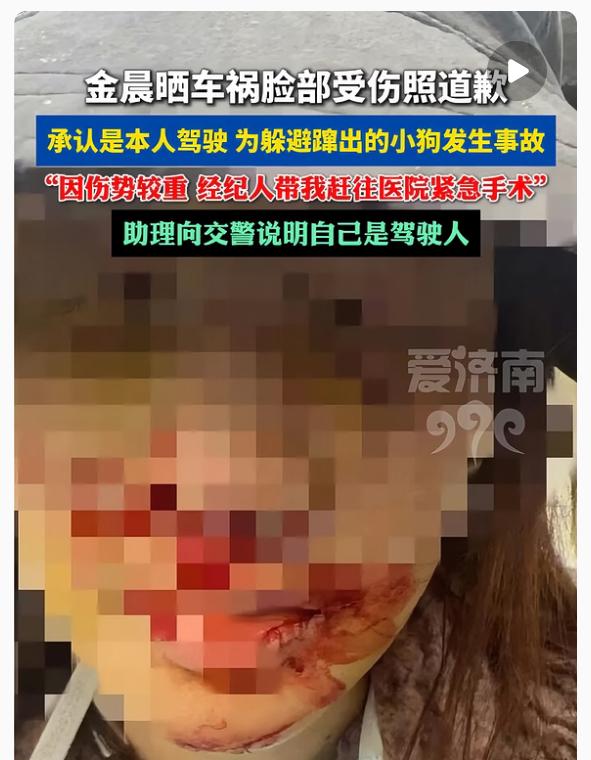 金晨这孩子，不能仔细看，越仔细看，越会发现。 去年三月那起事故被翻出来，说是她开