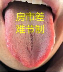刚结婚不久的年轻小伙，肾怎么虚的跟70岁老人一样，再不节制神仙都难调
 
患者情