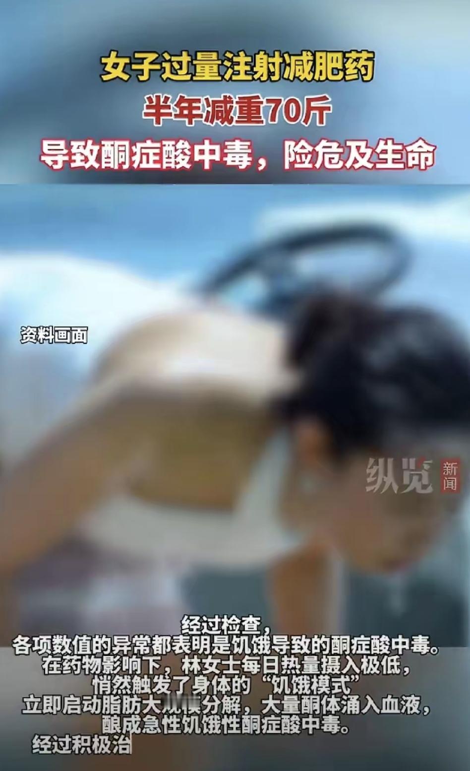 林女士被扶进急诊室时，脸发灰，话都说不清，吐的是黄水，肚子疼得直不起腰。半年掉这