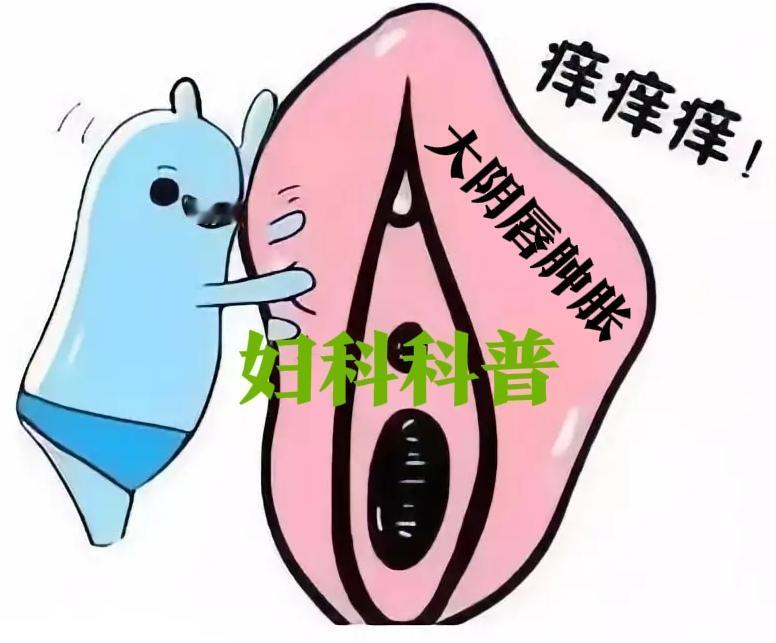 姐妹们，你们有没有经历过那种"下面突然肿了"的恐慌？我闺蜜上个月就差点因为这个冲