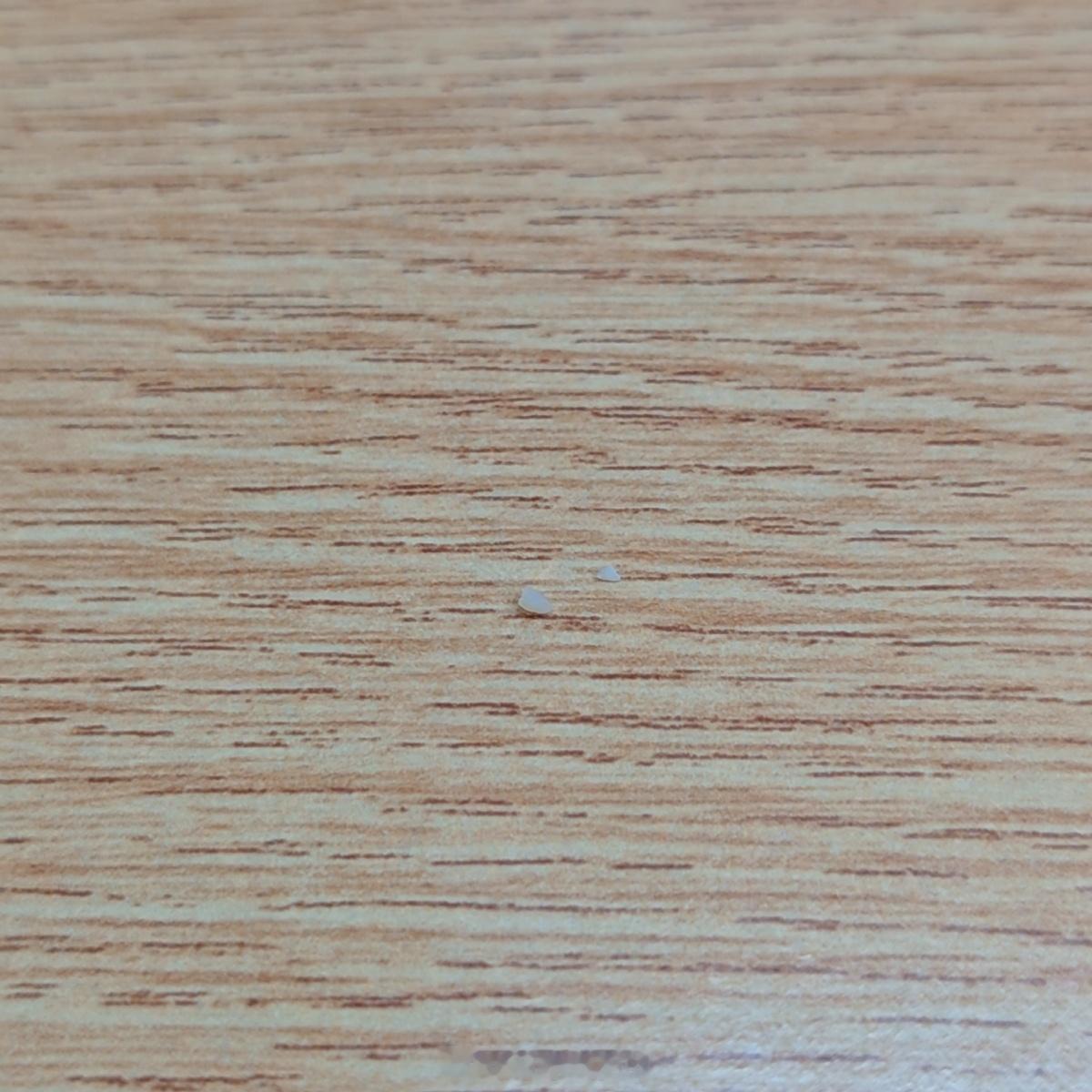 中午吃饭把牙齿给吃崩了 