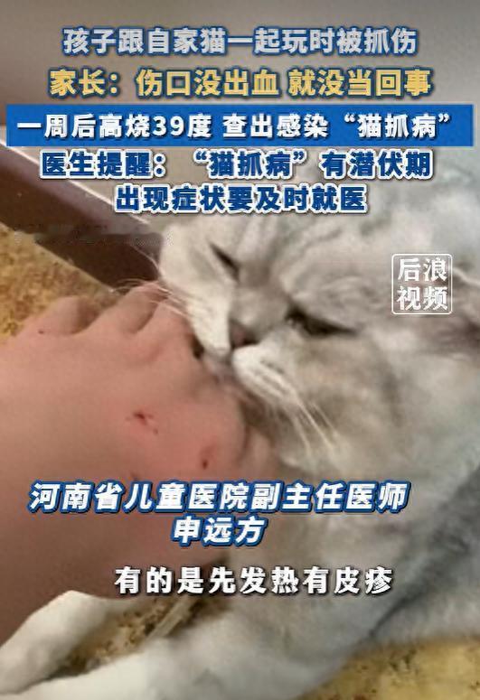 河南郑州，一名12岁的男孩在家中和宠物猫玩耍时，脸上被猫咪尖牙扎出三处细小伤口。