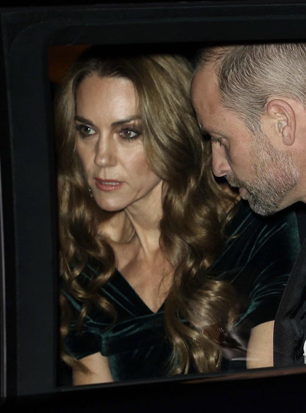 【揭皮凯特】凯特瘦的惊人，这是病态追求上镜还是迎合秃头的特殊审美或者是生病造成的