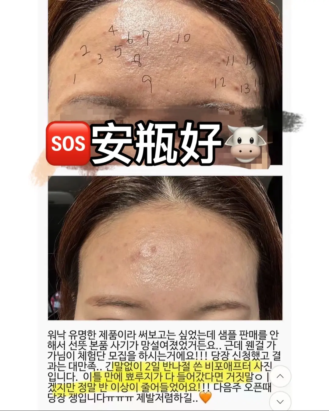 韩国sos安瓶就这一个。在韩国很火，真正的院线产品