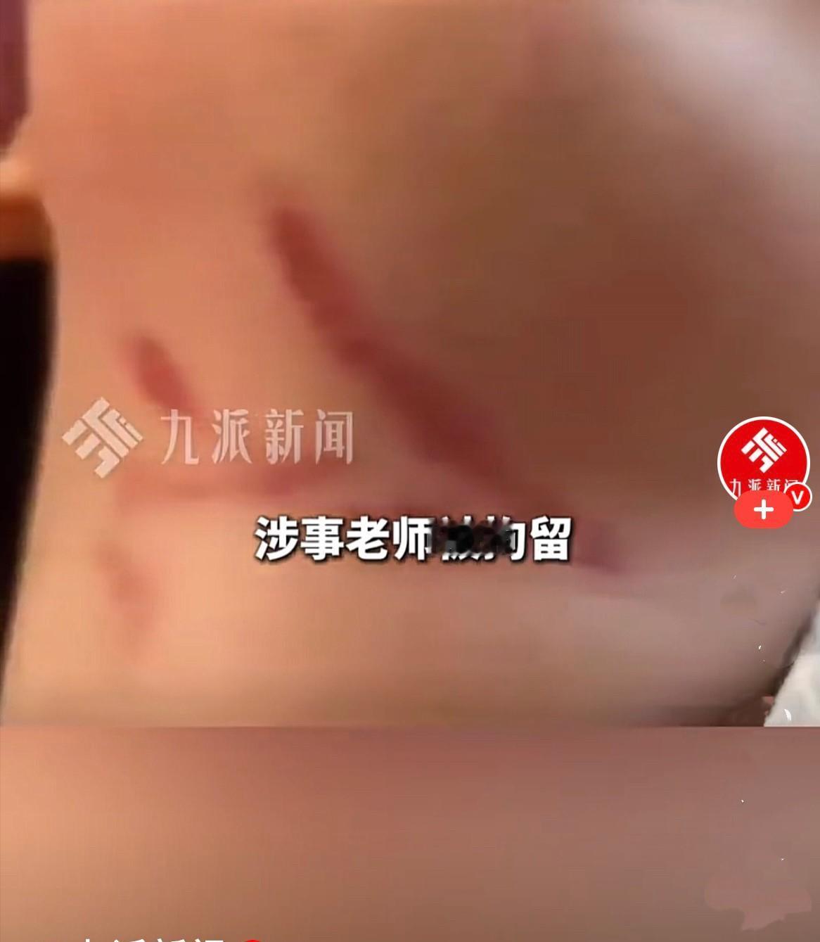“没有这个心，就别吃这碗饭！”广东中山，6月17日。一名3岁半女童就因不吃饭，被