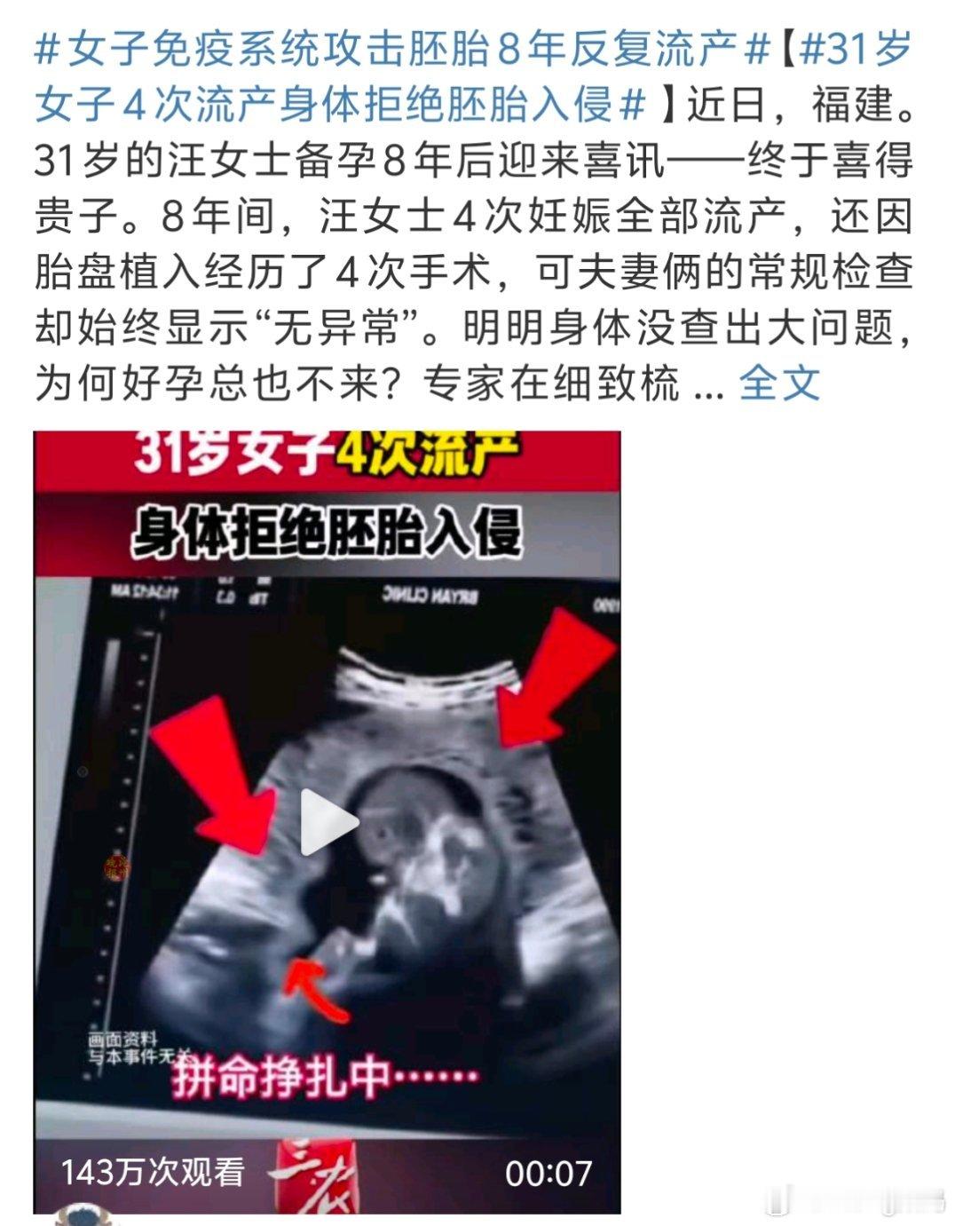 女子免疫系统攻击胚胎8年反复流产我的天8年，这对夫妻得多怀疑自己