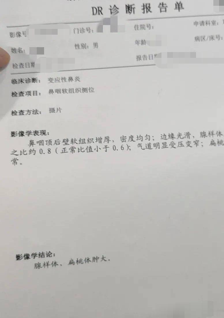 哎，真可惜！我天天科普，还是晚了
 
前段时间有个孩子来看鼻炎，我一看孩子，就让