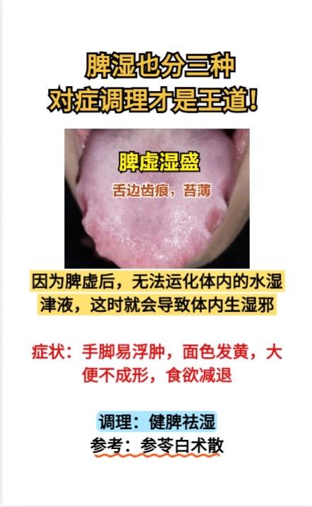 脾湿也分三种，对症调理才是王道！①脾虚湿盛——舌质淡，舌边有齿痕，舌苔白
因为脾