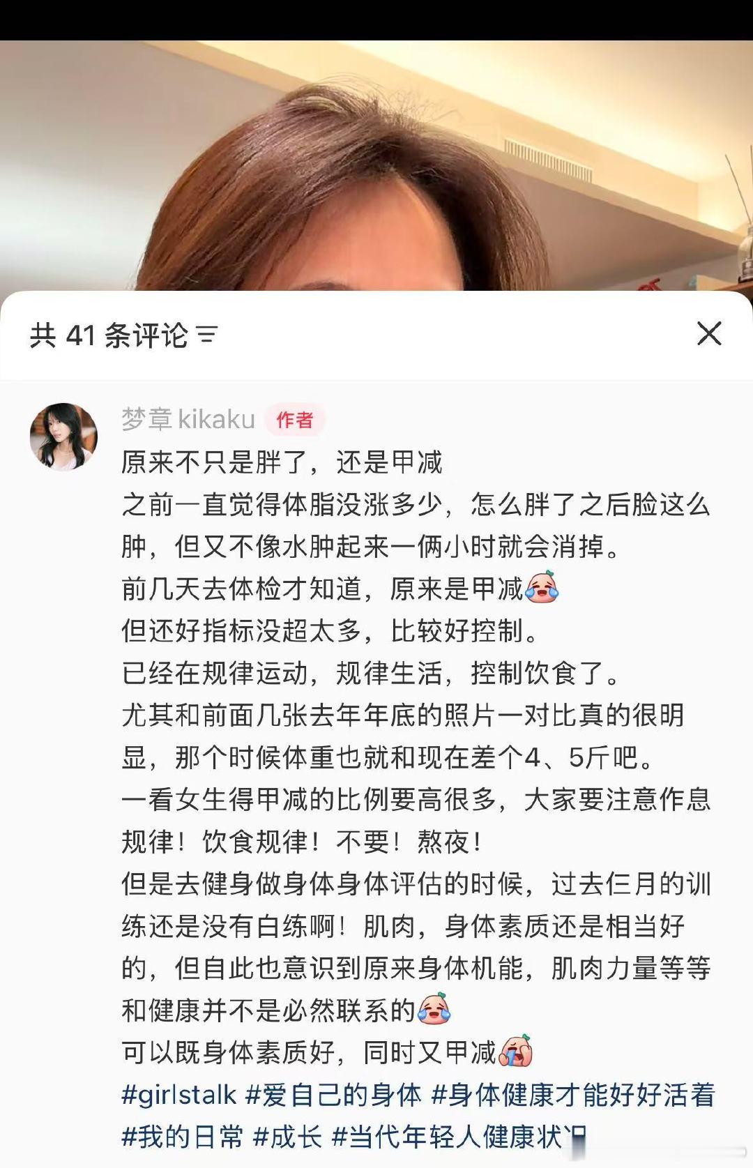 【刘梦章自曝甲减】刘梦章甲减 2月26日，刘梦章在社媒分享：“原来不只是胖了，还