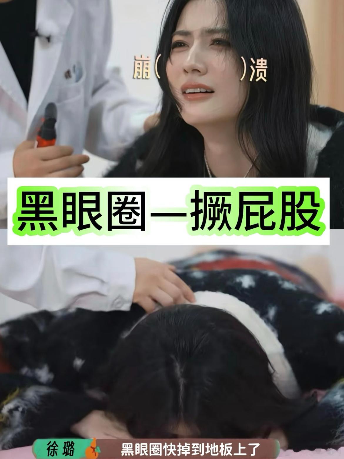 我就说看综艺能学到真东西吧，竟然可以撅屁股改善黑眼圈[doge] 