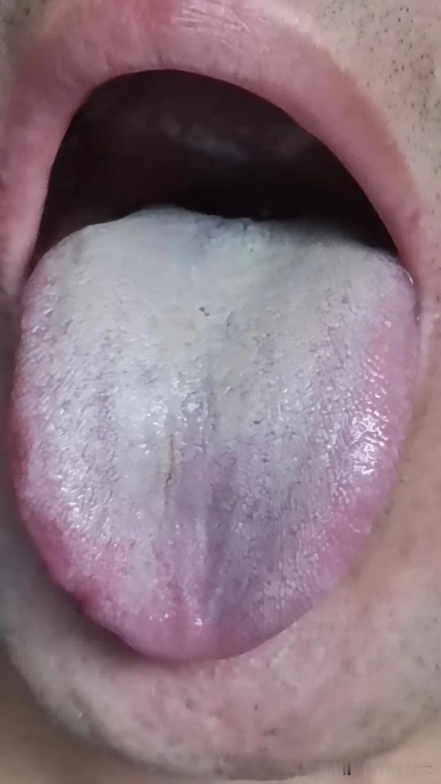 不怕你不懂，怕就怕你不懂装懂，你这不是自己给自己挖坑吗[晕][晕][晕]
大哥主