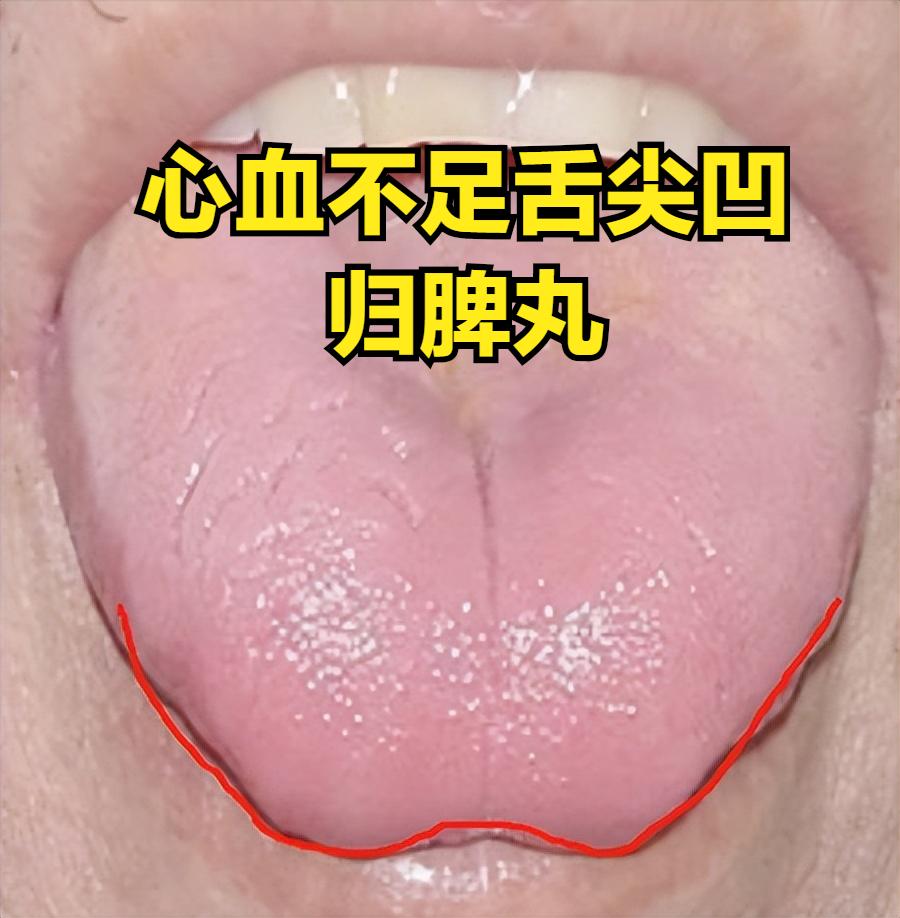 心血不足易手抖，肝血不足易抽筋，气血不足手脚麻！中医送你三个药，补血又养血！
 