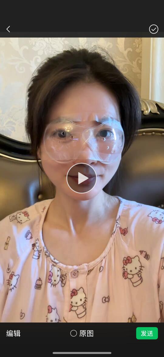 关于避雷我做了近视眼全飞秒手术多花了5000