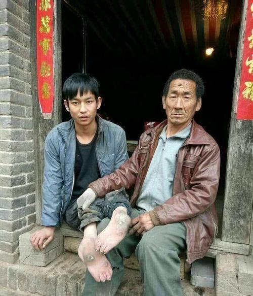 生来报恩！”河南一对夫妻生下残疾儿子不想要，于是，他们将儿子扔在草丛里。谁料，村