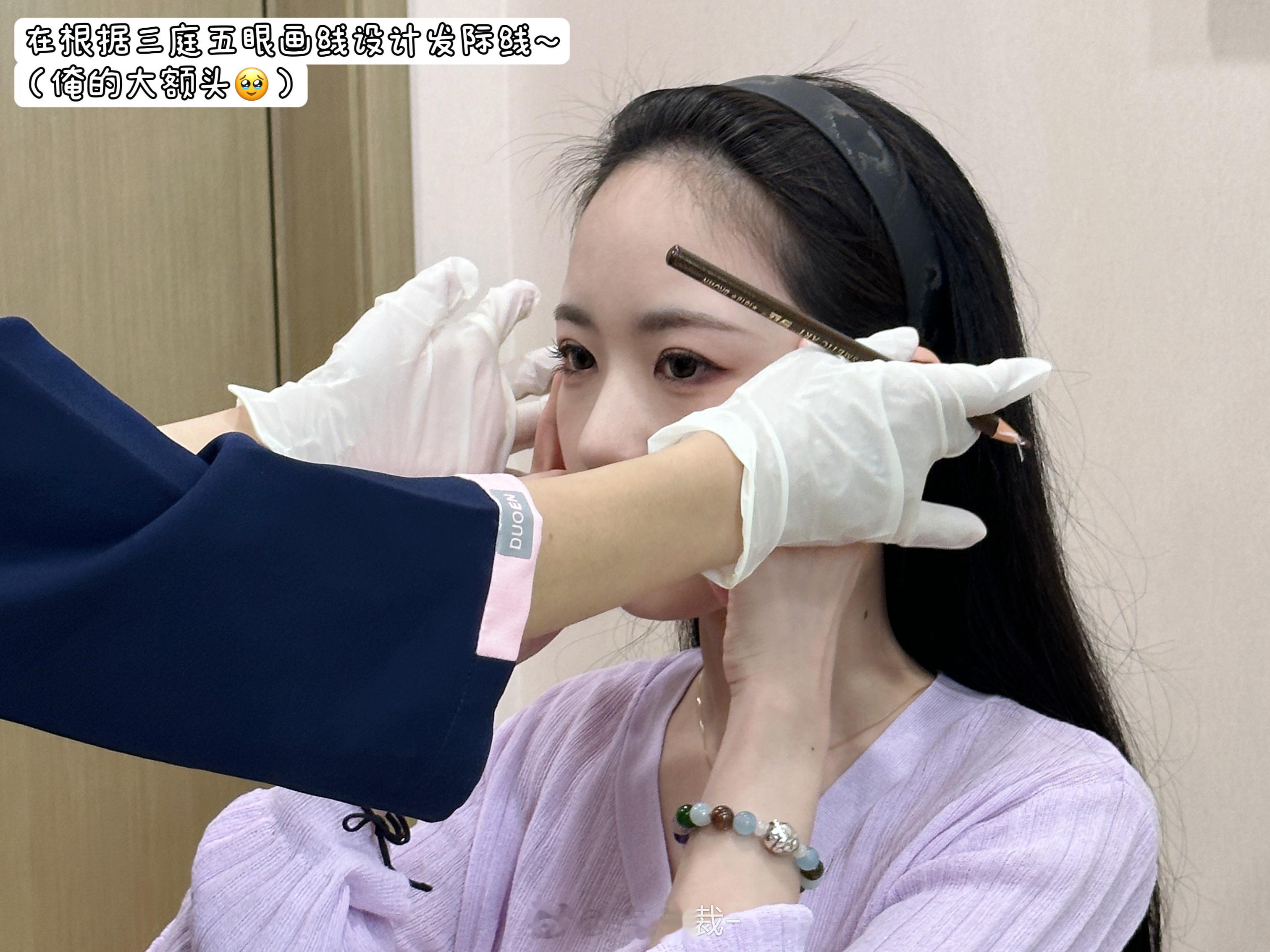 小兔的植发体验～[开学季]我是属于天生额头大 发际线高，后面头发巨厚，所以常年都