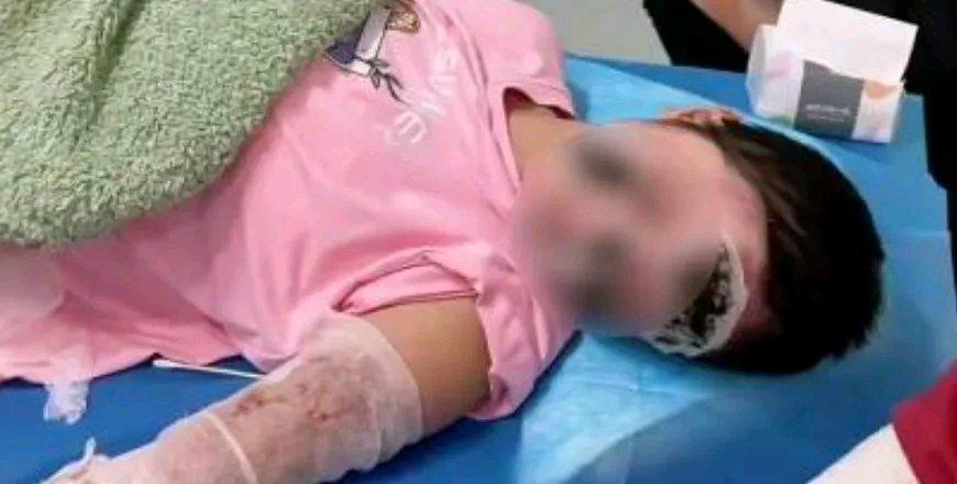 女子将手机充电到天亮，充电器自燃爆炸起火，全身70%烧伤！当事人：大家有这个习惯