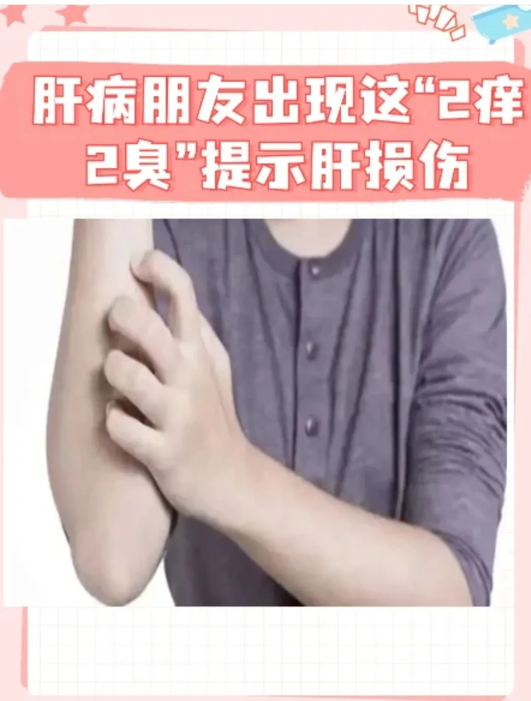 肝病朋友出现这“2痒2臭”提示肝损伤