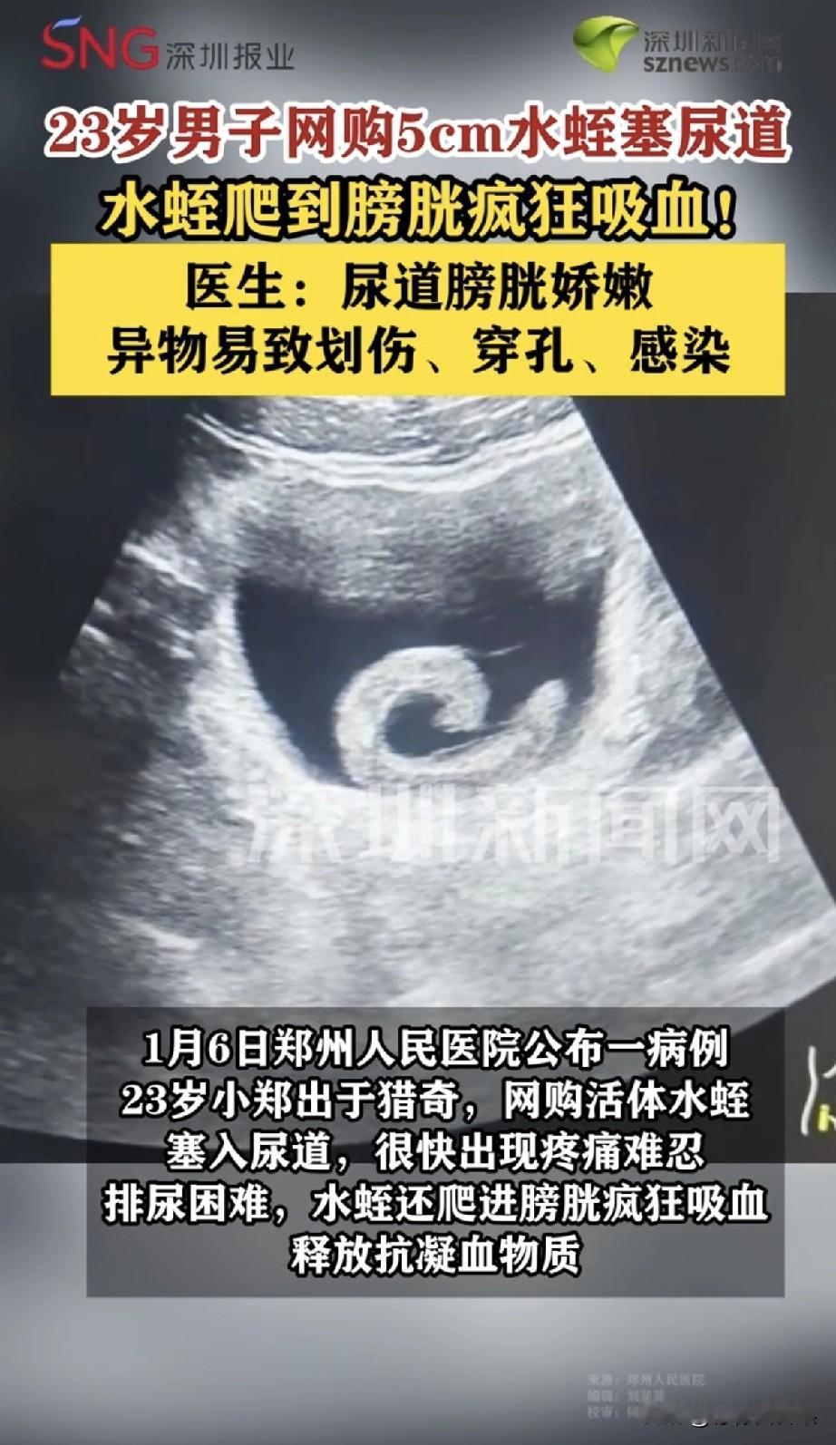 普天之下无奇不有！郑州23岁小伙的操作直接把我看呆了！就为了满足猎奇心，网购5厘