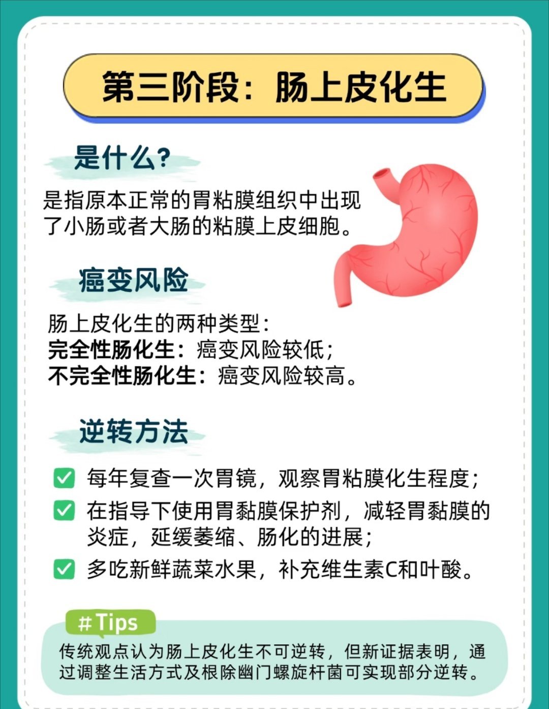 胃病向胃癌发展有5个征兆胃癌早期症状与普通胃病相似，极易被忽视。​​出现持续性上