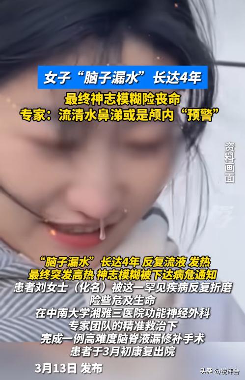 女子流清水鼻涕20天，以为是鼻炎，医生一句话吓懵：那是你脑子里的水！

😱 太