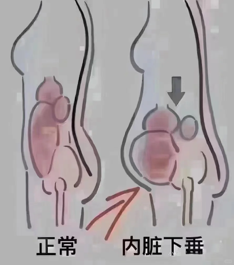 产后肚子大做jamu有用吗？