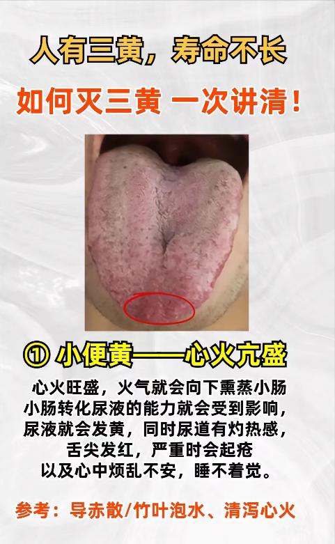 人有三慌，寿命不长！三黄指的哪三黄？又该如何调理？一文讲清
1.小便黄——心火旺