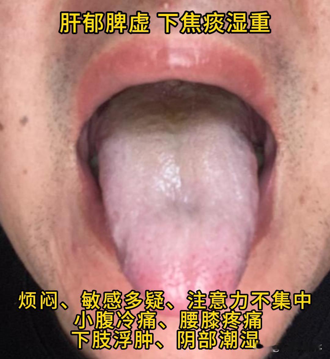 今天有时间，可以帮大家看看舌象。

有需要的，尽管把你的舌象照片发过来吧！越早发