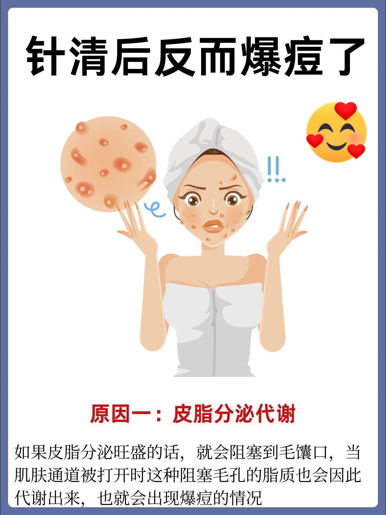 针清后反而爆痘了。痘痘肌针清祛痘