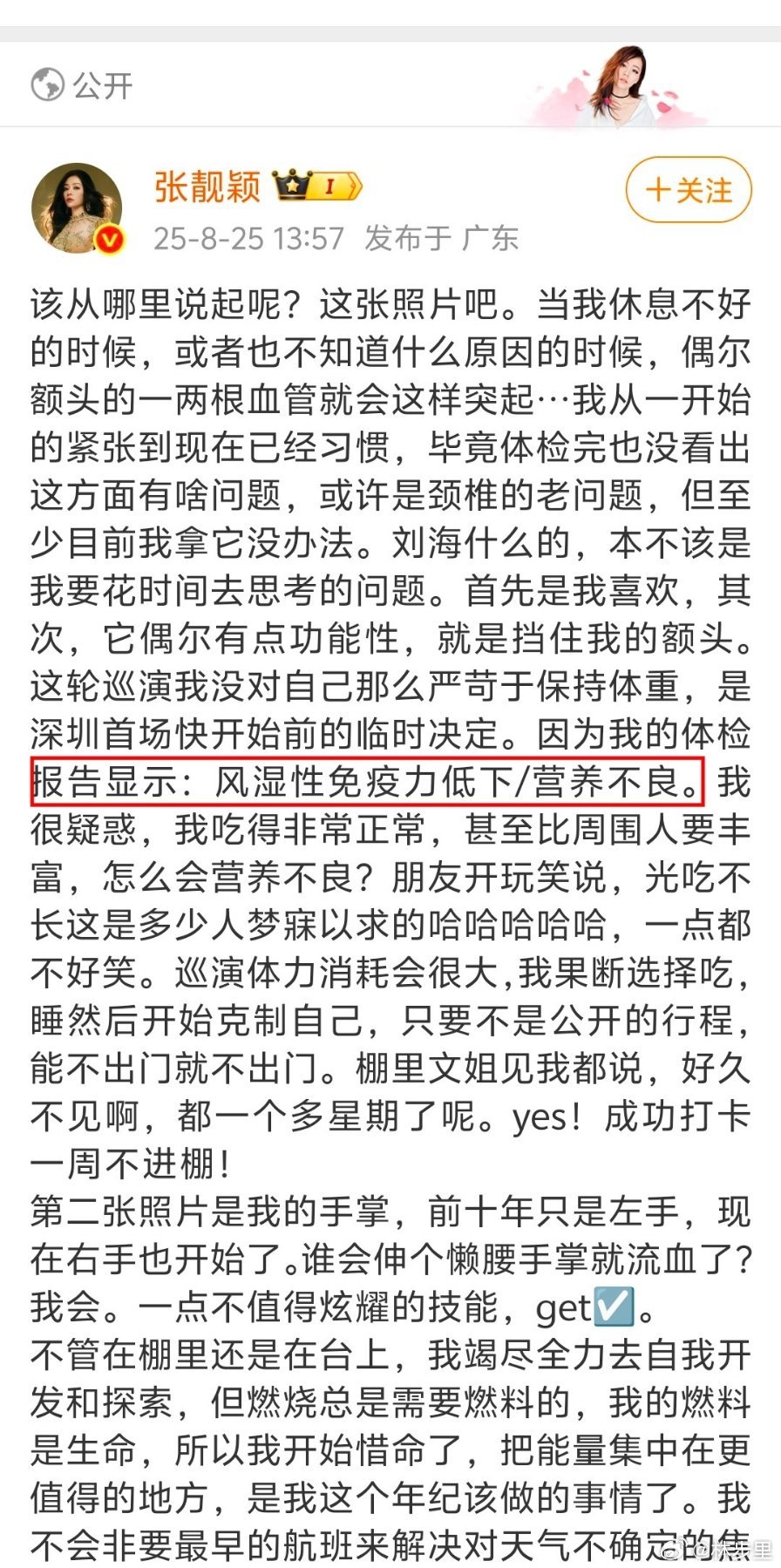 张靓颖风湿性免疫力低下张靓颖，体检报告风湿性免疫力低下/营养不良[柯基]。这姐的