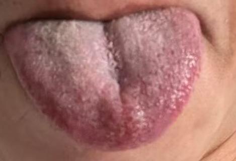 胸闷易怒凌晨早醒，多是肝郁阴虚气血不足







自从过了四十岁感觉身体状态