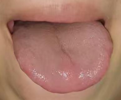 为什么体质调理总不见好？多半是体内瘀堵在作怪







对于伤精过度的朋友而