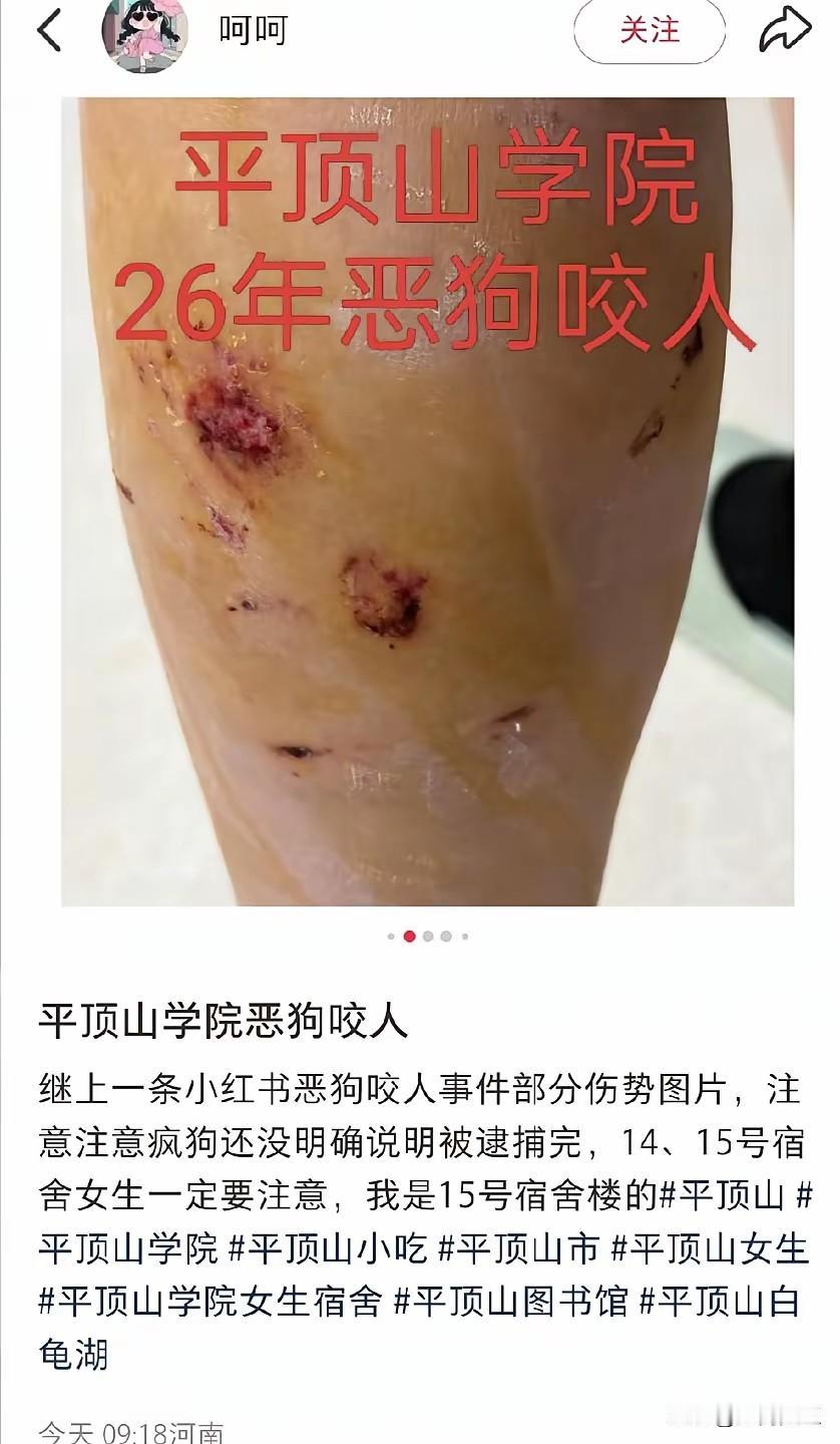 [捂脸]，平顶山学院怎么做都是错❌！今天突然刷到这个消息感到五味杂陈，不知道怎么