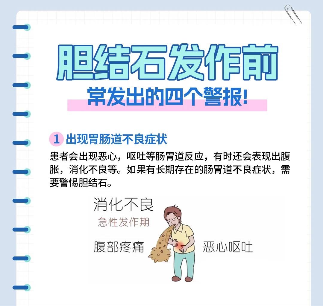 胆结石不是突然发作！读懂发作前的 4 个预警信号