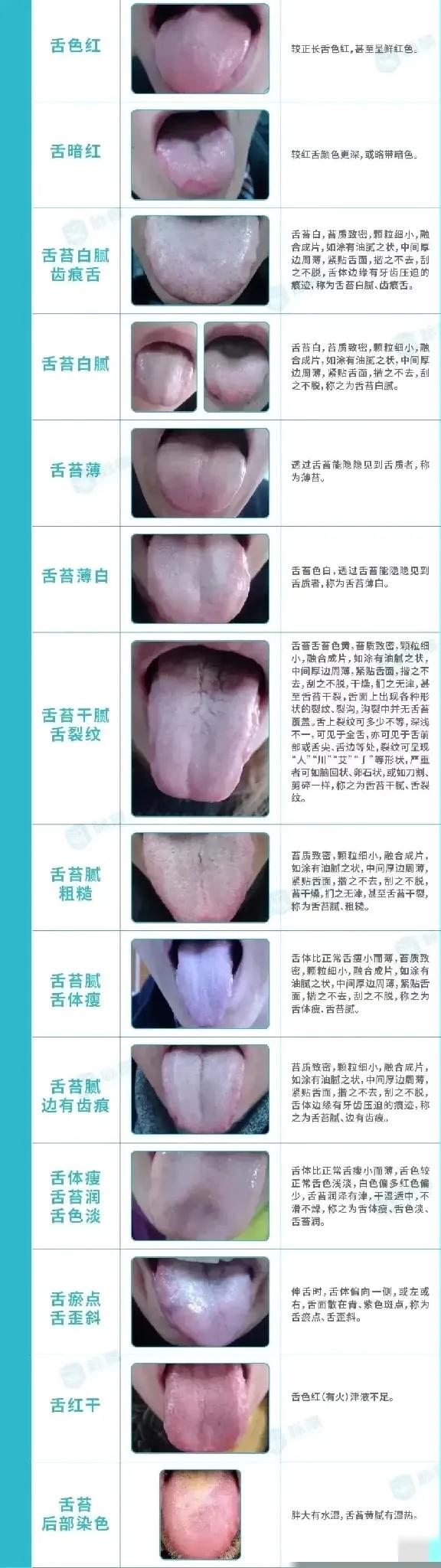 想知道你的健康状况吗？今天教大家一个神奇的舌诊方法，只需观察自己的舌头，就能大致