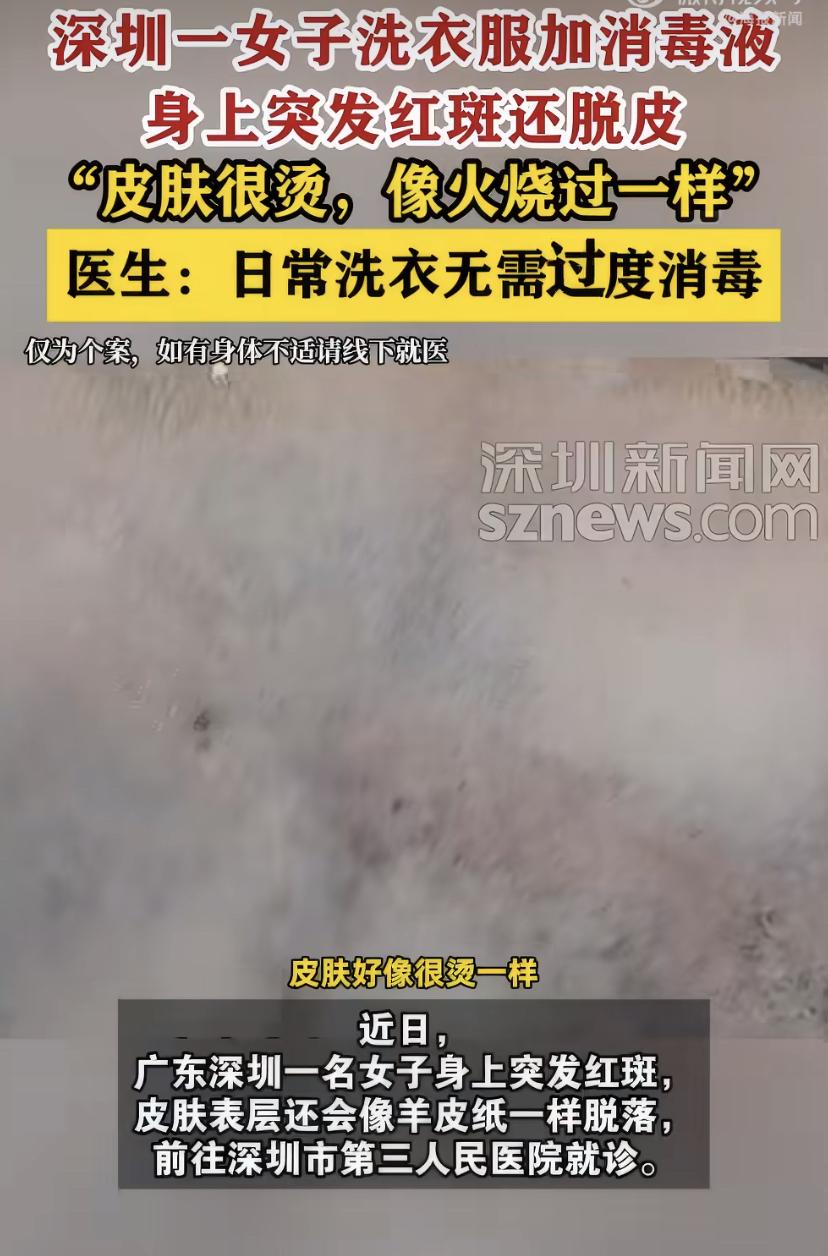 深圳一女子身上突然冒红斑，皮肤还像羊皮纸一样往下掉，去医院一查，竟是洗衣时加的消