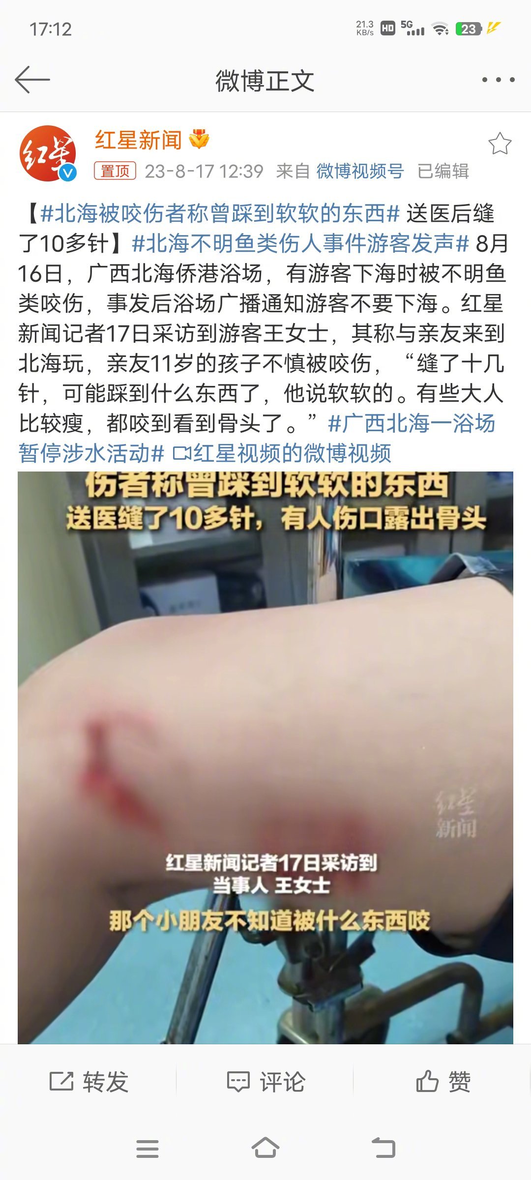 #北海被咬伤者称曾踩到软软的东西#网友评论说：不明生物咬伤游客，殷商太师闻仲，远