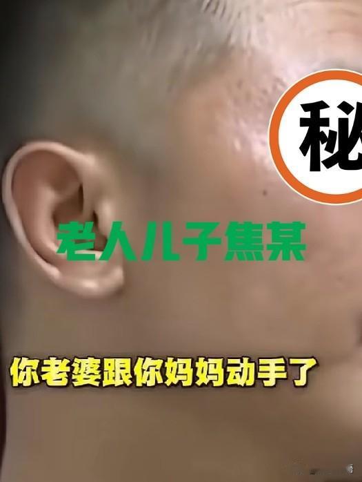 婆婆被儿媳打断肋骨，儿子的态度，让人不敢置信！

儿媳对公公、婆婆大不敬，有儿媳