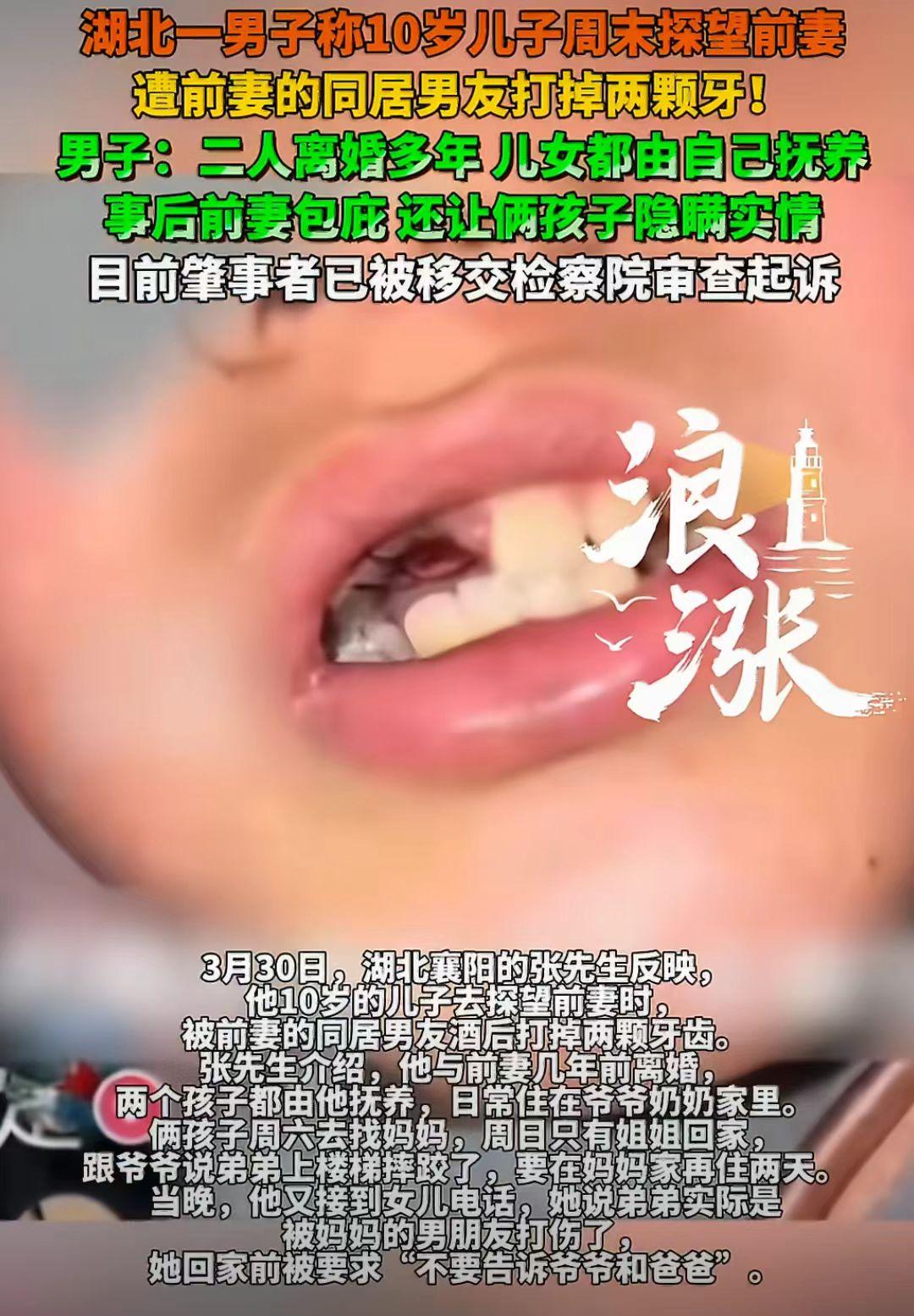 10岁男孩小杰放假到母亲家探望母亲时，被母亲的男朋友暴力殴打，被打掉两颗门牙后，