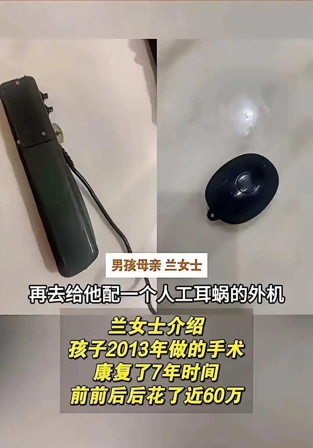 一桩关于儿童人工耳蜗失窃的事件近期在网络上引发热议，焦点并非单纯的失窃行为，而是