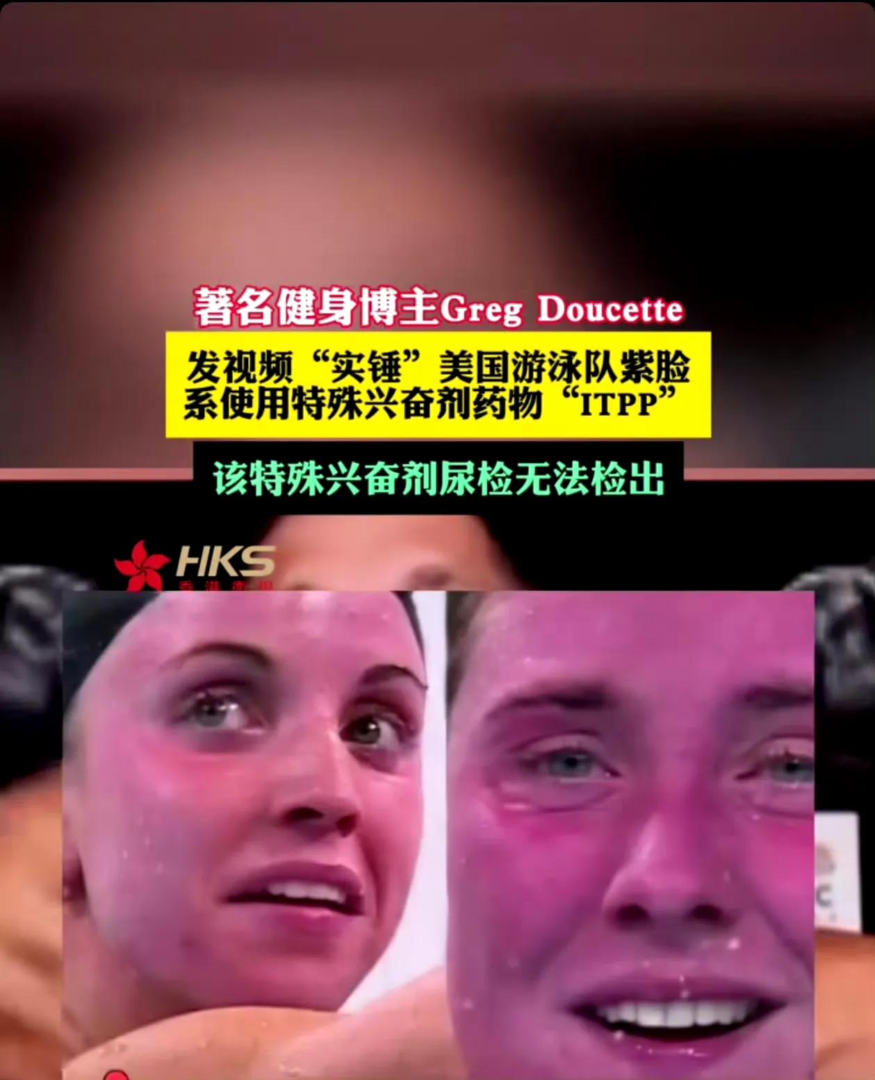 如果国际社会再不对美国运动员的兴奋剂问题施加压力的话，那么到了2028年洛杉矶奥
