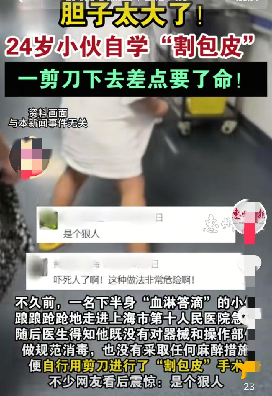 “是个狠人！”上海，一24岁男子因自幼包皮过长反复感染，居然在家自割包皮，开始以