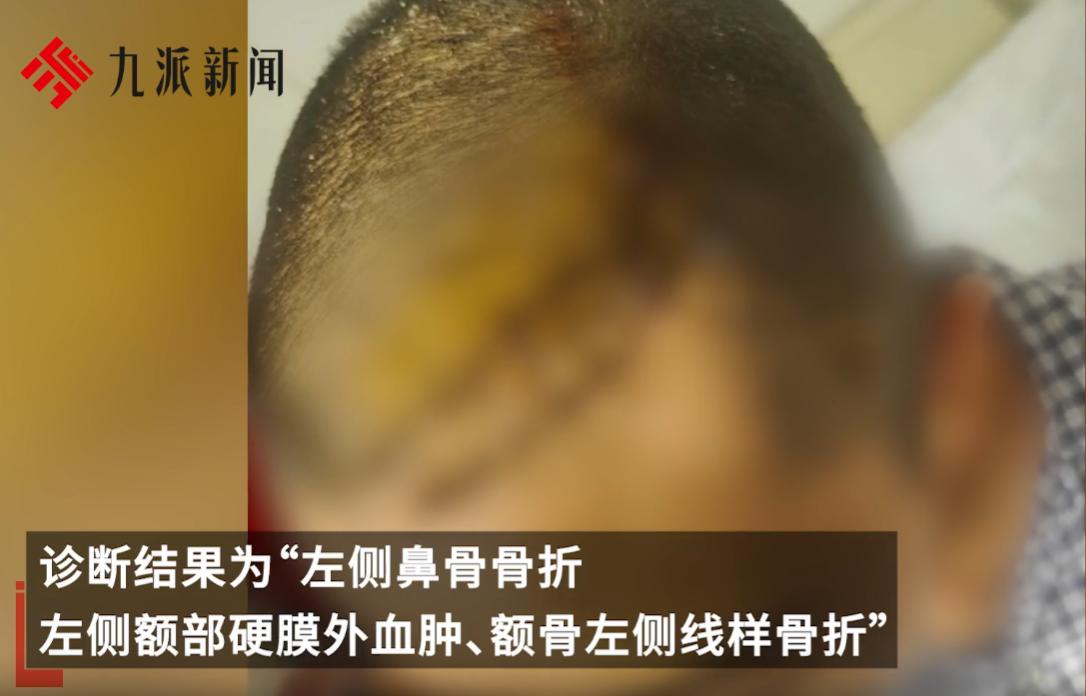 “必须严惩！”陕西榆林，一个喝醉酒的班主任到了学生宿舍后，二话不说，冲着中学生就