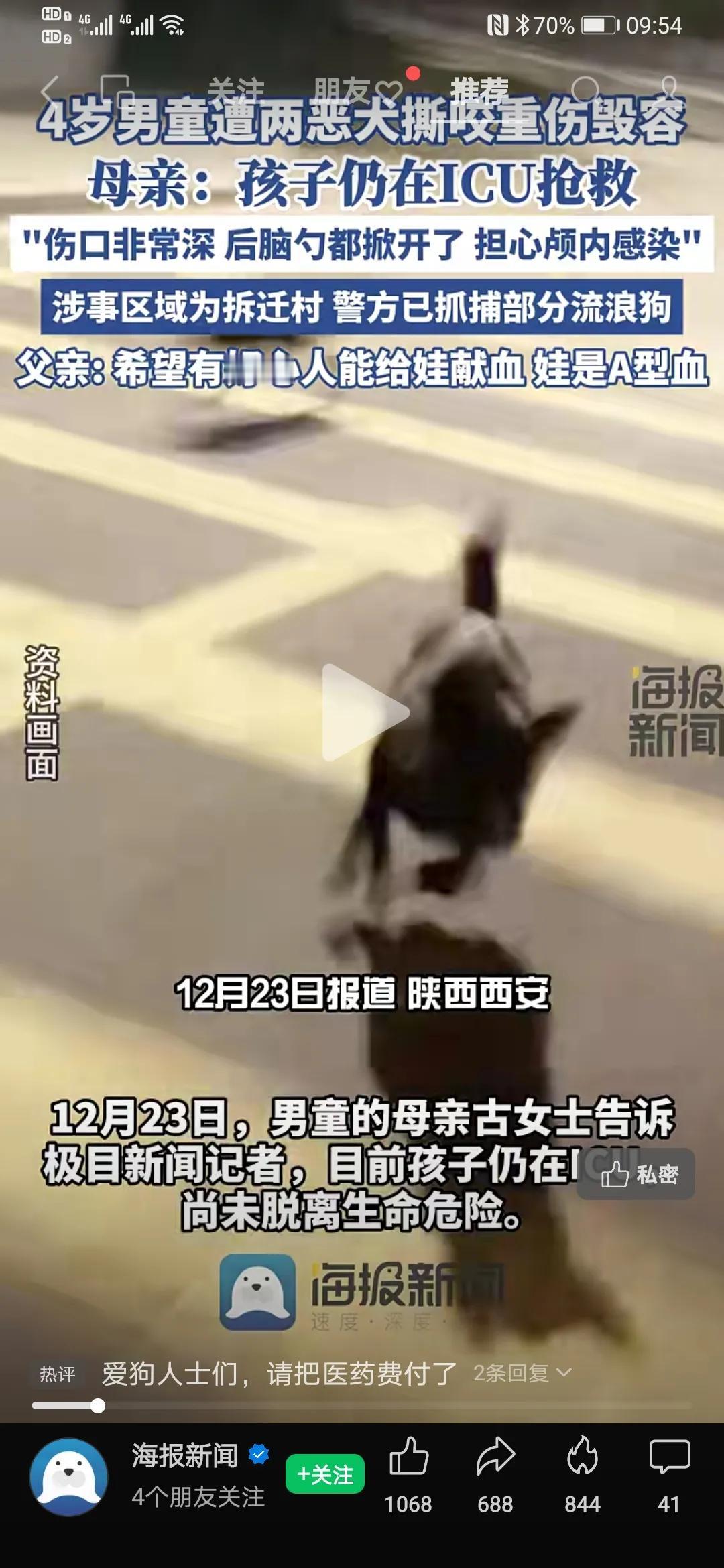 恶犬又双叒伤人！
1.西安幼童遭两恶犬咬伤毁容
2.赣州女童遭四大型犬撕咬3分钟