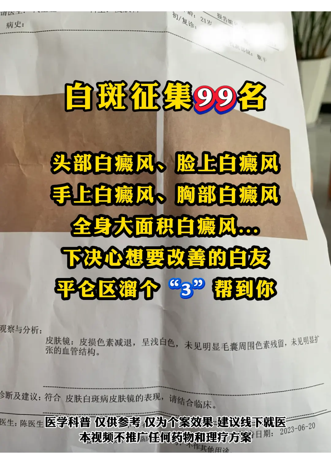 白癜风 白斑 皮肤健康
