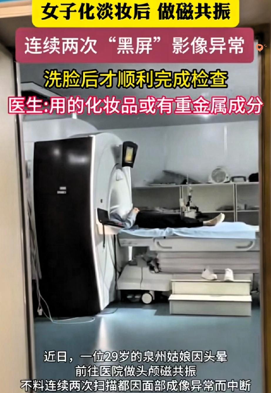 解释不清了！
做磁共振居然败在了一张脸上，这事真的太颠覆认知了。
 
福建一位2