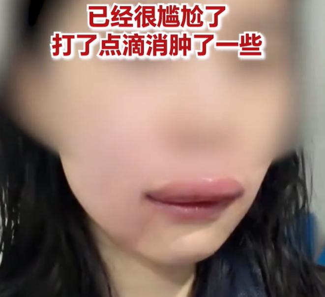 四川巴中一位女生，和喜欢的人终于走到结婚这天。头天晚上去厕所刷牙开窗，一只马蜂飞