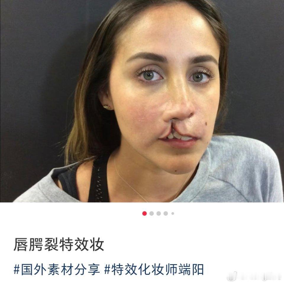 二手烟 唇腭裂还有仿妆的…少抽烟别吸二手烟吧 